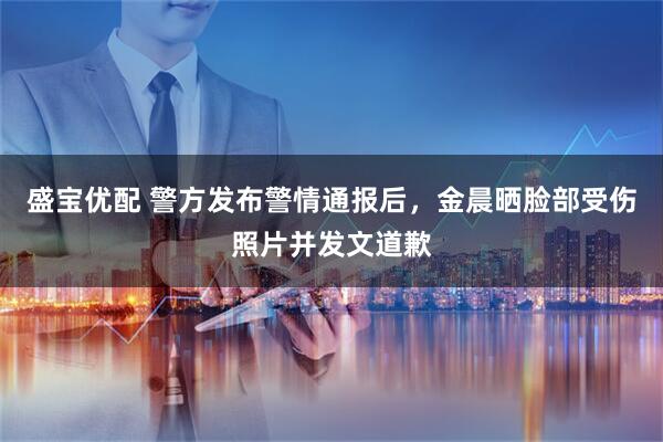盛宝优配 警方发布警情通报后，金晨晒脸部受伤照片并发文道歉